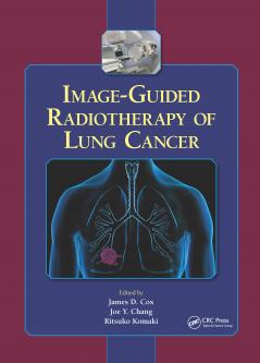 Image-Guided Radiotherapy of Lung Cancer