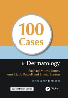 100 Cases in Dermatology