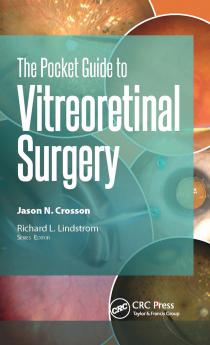 Pocket Guide to Vitreoretinal Surgery