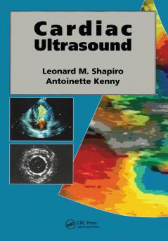 Cardiac Ultrasound
