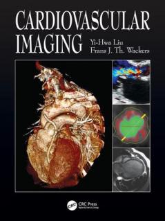 Cardiovascular Imaging