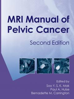 MRI Manual of Pelvic CancerSecond Edition