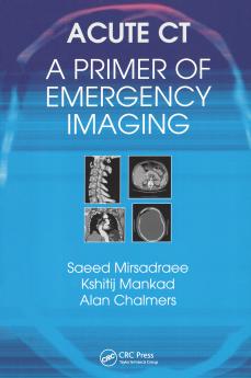 Acute CT: A Primer of Emergency Imaging