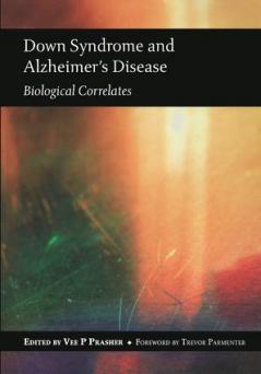 Down Syndrome and Alzheimer's Disease