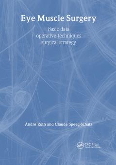 Eye Muscle Surgery: Basic Data