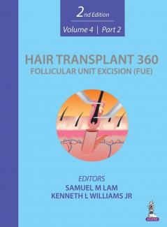 Hair Transplant 360: Follicular Unit Excision (FUE)_2