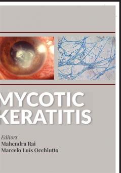 Mycotic Keratitis