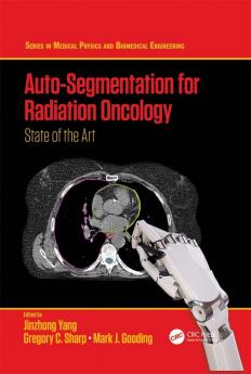 Auto-Segmentation for Radiation Oncology
