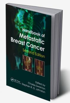 Handbook of Metastatic Breast Cancer