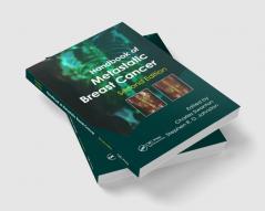 Handbook of Metastatic Breast Cancer