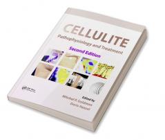 Cellulite