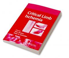 Critical Limb Ischemia