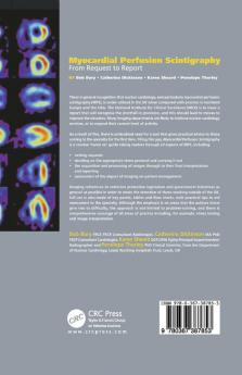 Myocardial Perfusion Scintigraphy