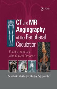 CT and MR Angiography of the Peripheral Circulation