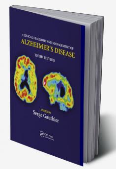 Clinical Diagnosis and Management of Alzheimer's Disease