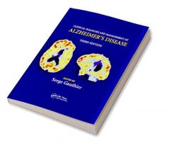 Clinical Diagnosis and Management of Alzheimer's Disease