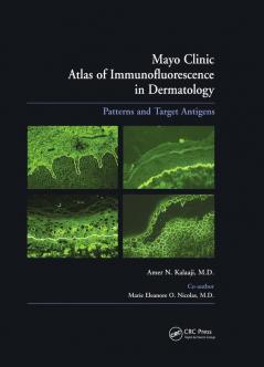 Mayo Clinic Atlas of Immunofluorescence in Dermatology