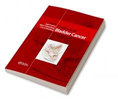 Textbook of Bladder Cancer