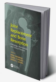 Joint Replacement and Bone Resorption