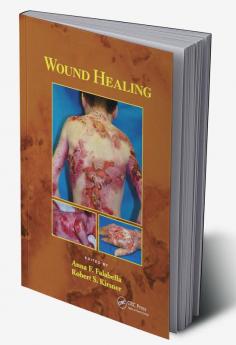 Wound Healing