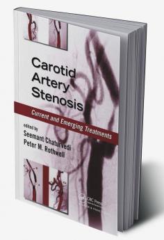 Carotid Artery Stenosis