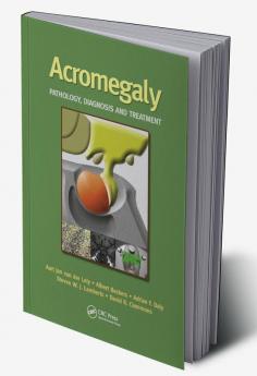 Acromegaly