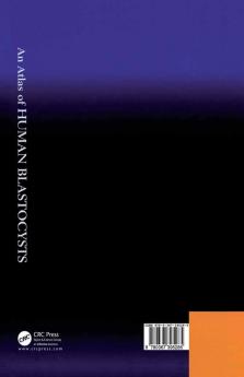 Atlas of Human Blastocysts