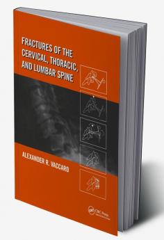 Fractures of the Cervical Thoracic and Lumbar Spine