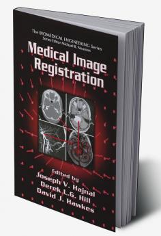 Medical Image Registration