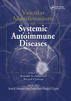 Vascular Manifestations of Systemic Autoimmune Diseases