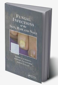 Fungal Infections of the Skin and Nails