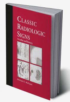 Classic Radiologic Signs