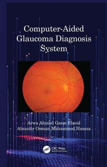 Computer-Aided Glaucoma Diagnosis System