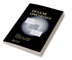 Ocular Oncology