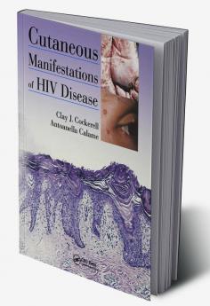 Cutaneous Manifestations of HIV Disease