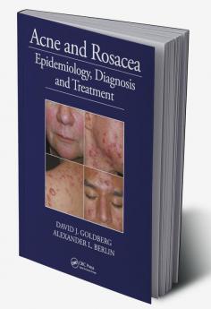 Acne and Rosacea