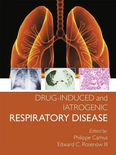 Drug-induced and Iatrogenic Respiratory Disease