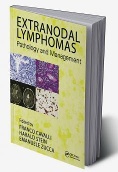 Extranodal Lymphomas