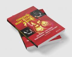 Congenital Heart Disease in Adults