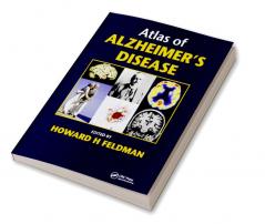 Atlas of Alzheimer's Disease