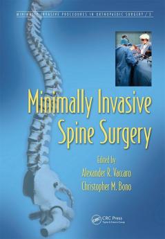 Minimally Invasive Spine Surgery