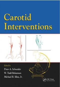 Carotid Interventions