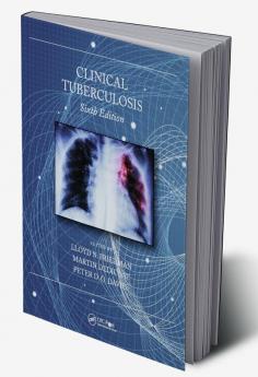 Clinical Tuberculosis