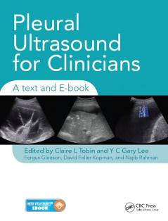 Pleural Ultrasound for Clinicians