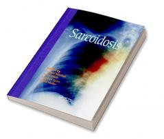 Sarcoidosis