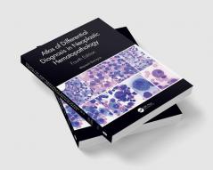 Atlas of Differential Diagnosis in Neoplastic Hematopathology