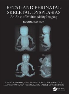 Fetal and Perinatal Skeletal Dysplasias