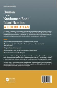 Human and Nonhuman Bone Identification