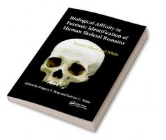 Biological Affinity in Forensic Identification of Human Skeletal