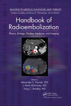 Handbook of Radioembolization